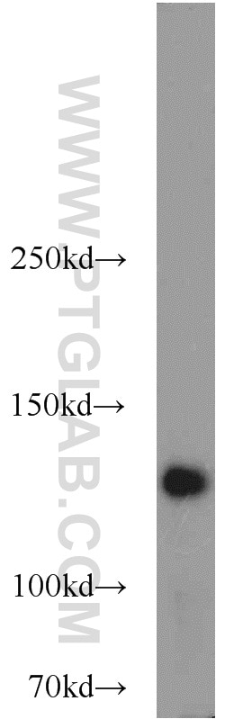 Western Blot (WB) analysis of HeLa cells using NUP133 Polyclonal antibody (12405-1-AP)