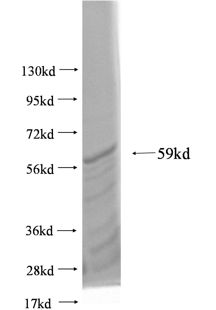 NUP133 fusion protein Ag3100 SDS-PAGE