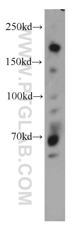 Western Blot (WB) analysis of A431 cells using NUP153 Polyclonal antibody (14189-1-AP)