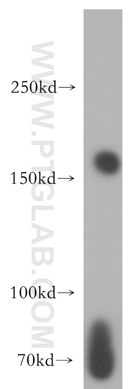 Western Blot (WB) analysis of K-562 cells using NUP153 Polyclonal antibody (14189-1-AP)