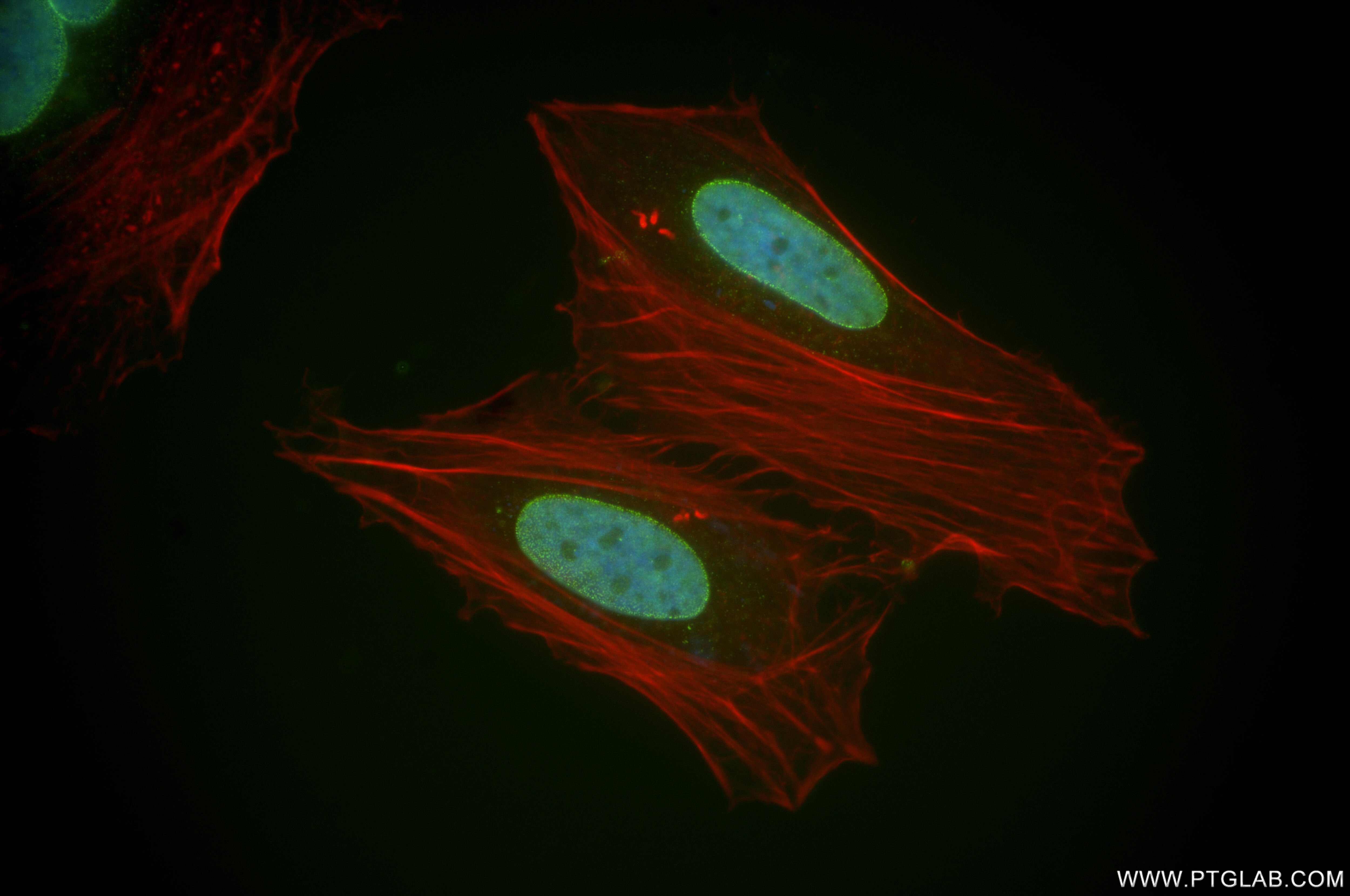 Immunofluorescence (IF) / fluorescent staining of HeLa cells using NUP153 Recombinant antibody (86622-1-RR)