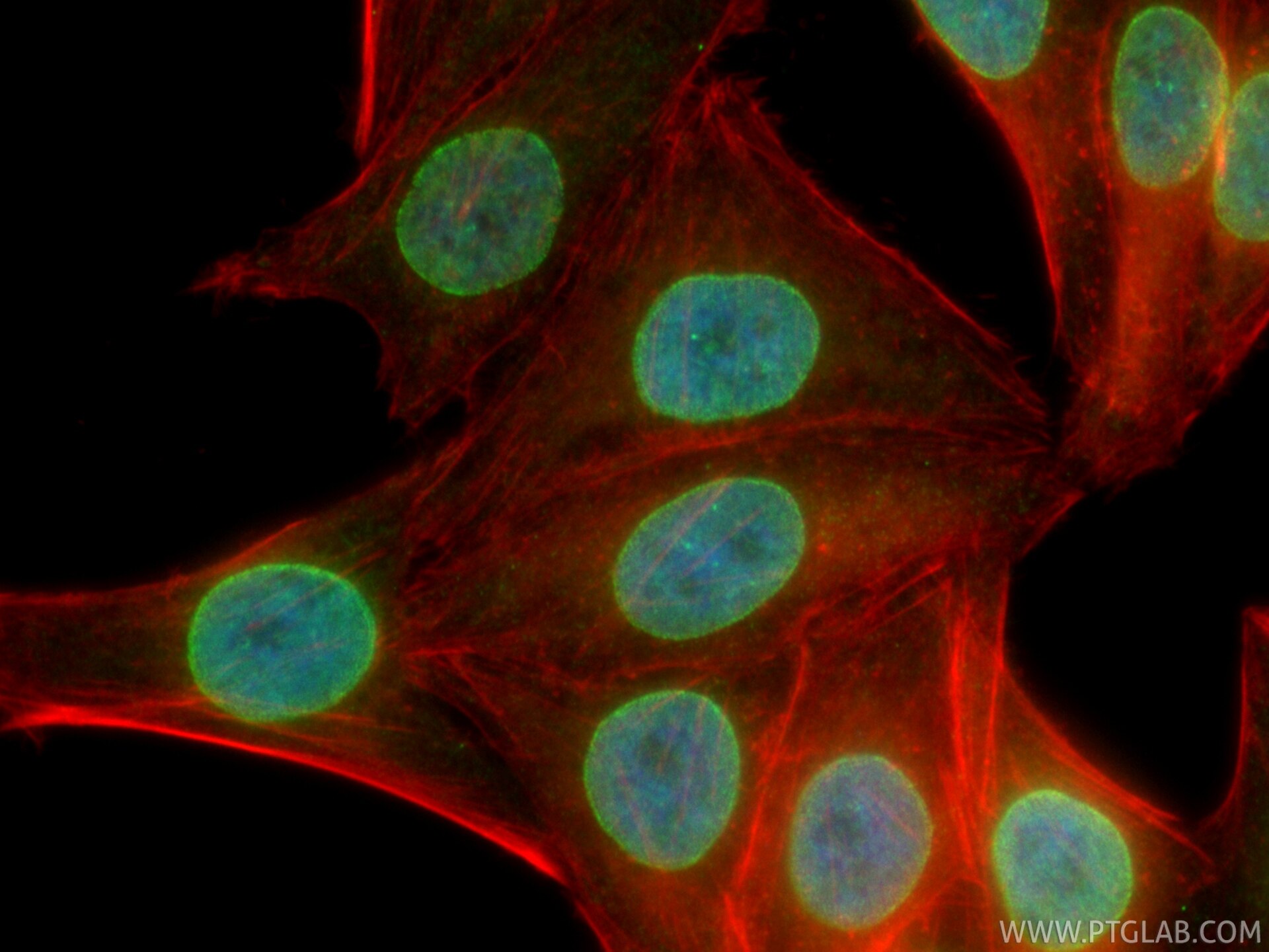 IF Staining of HepG2 using CL488-86622 Immunofluorescence (IF) / fluorescent staining of HepG2 cells using CoraLite® Plus 488-conjugated NUP153 Recombinant m (CL488-86622)