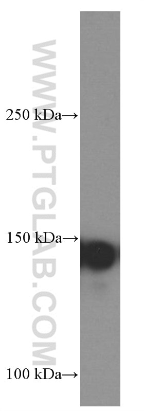 Western Blot (WB) analysis of HeLa cells using NUP155 Monoclonal antibody (66359-1-Ig)