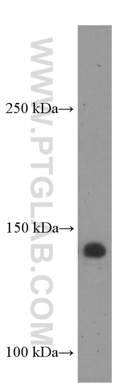 Western Blot (WB) analysis of ROS1728 cells using NUP155 Monoclonal antibody (66359-1-Ig)
