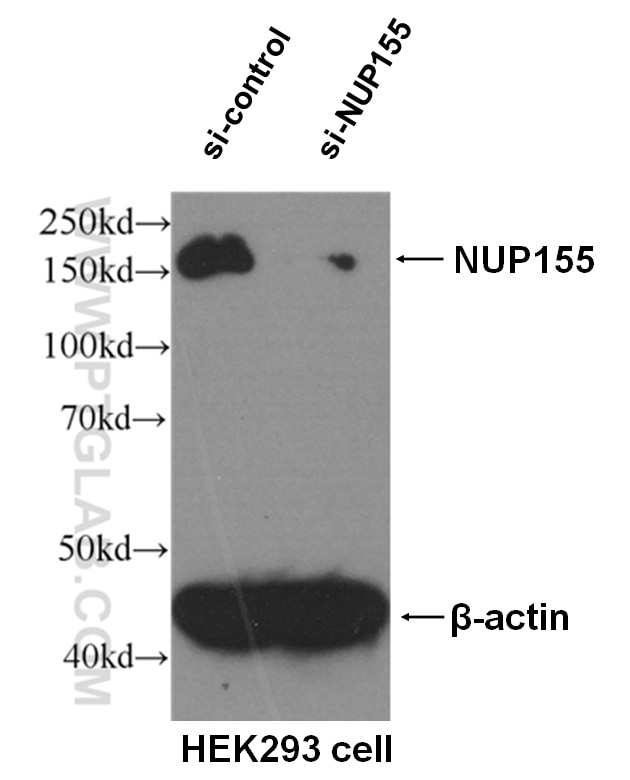 Western Blot (WB) analysis of HEK293 cells using NUP155 Monoclonal antibody (66359-1-Ig)