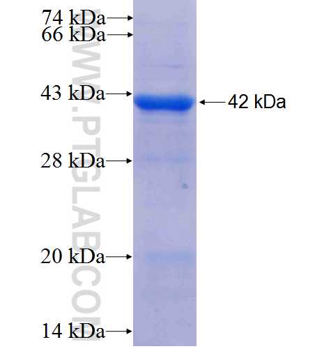 NUP155 fusion protein Ag3638 SDS-PAGE