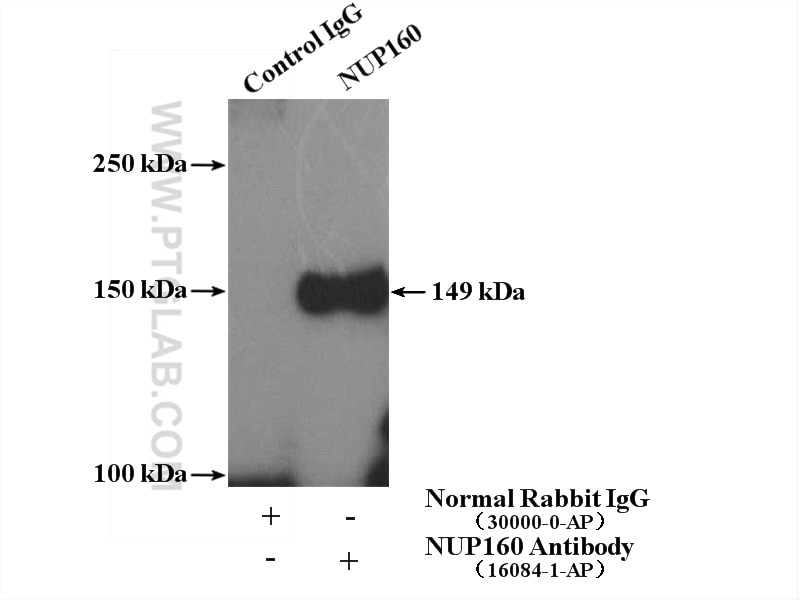 Immunoprecipitation (IP) experiment of HeLa cells using NUP160 Polyclonal antibody (16084-1-AP)