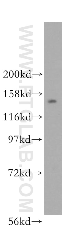 Western Blot (WB) analysis of HeLa cells using NUP160 Polyclonal antibody (16084-1-AP)