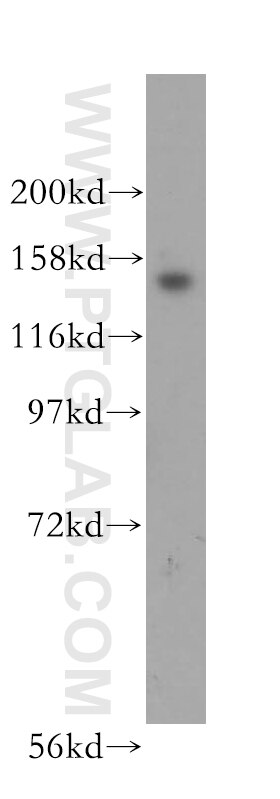 Western Blot (WB) analysis of human brain tissue using NUP160 Polyclonal antibody (16084-1-AP)