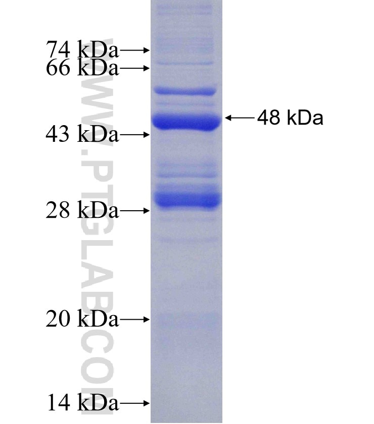 NUP160 fusion protein Ag9083 SDS-PAGE