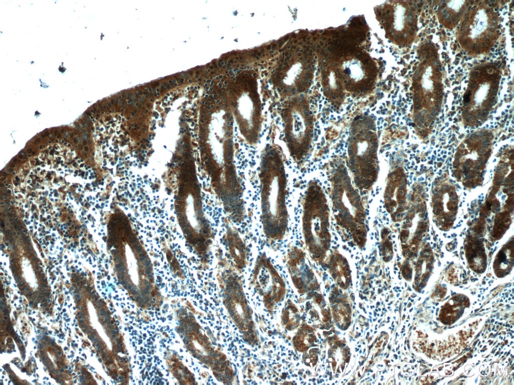 IHC staining of human stomach using 24439-1-AP