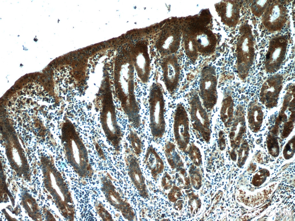 Immunohistochemistry (IHC) staining of human stomach tissue using NUP205 Polyclonal antibody (24439-1-AP)