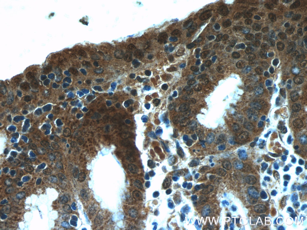 Immunohistochemistry (IHC) staining of human stomach tissue using NUP205 Polyclonal antibody (24439-1-AP)