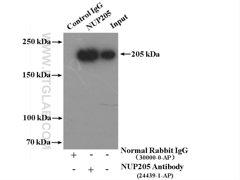 Immunoprecipitation (IP) experiment of HeLa cells using NUP205 Polyclonal antibody (24439-1-AP)