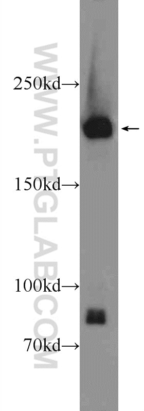 Western Blot (WB) analysis of Jurkat cells using NUP205 Polyclonal antibody (24439-1-AP)