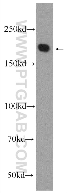 Western Blot (WB) analysis of HeLa cells using NUP205 Polyclonal antibody (24439-1-AP)