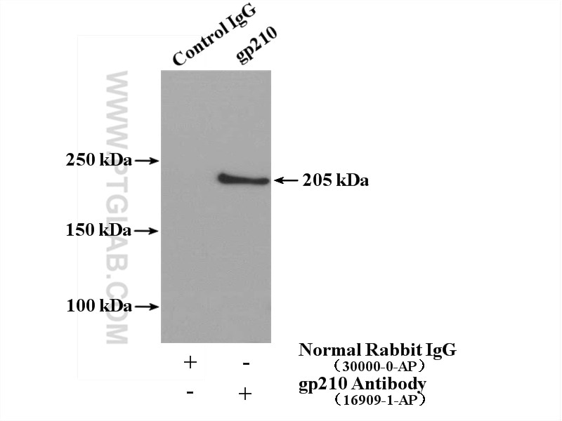 Immunoprecipitation (IP) experiment of HeLa cells using gp210 Polyclonal antibody (16909-1-AP)