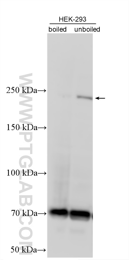 Western Blot (WB) analysis of various lysates using gp210 Polyclonal antibody (16909-1-AP)