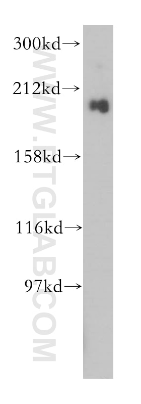 Western Blot (WB) analysis of mouse lung tissue using gp210 Polyclonal antibody (16909-1-AP)