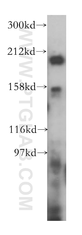 Western Blot (WB) analysis of MCF-7 cells using gp210 Polyclonal antibody (16909-1-AP)