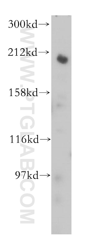 Western Blot (WB) analysis of mouse thymus tissue using gp210 Polyclonal antibody (16909-1-AP)