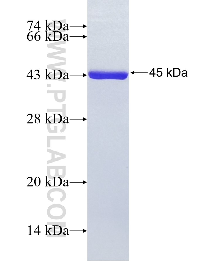 NUP210 fusion protein Ag10494 SDS-PAGE