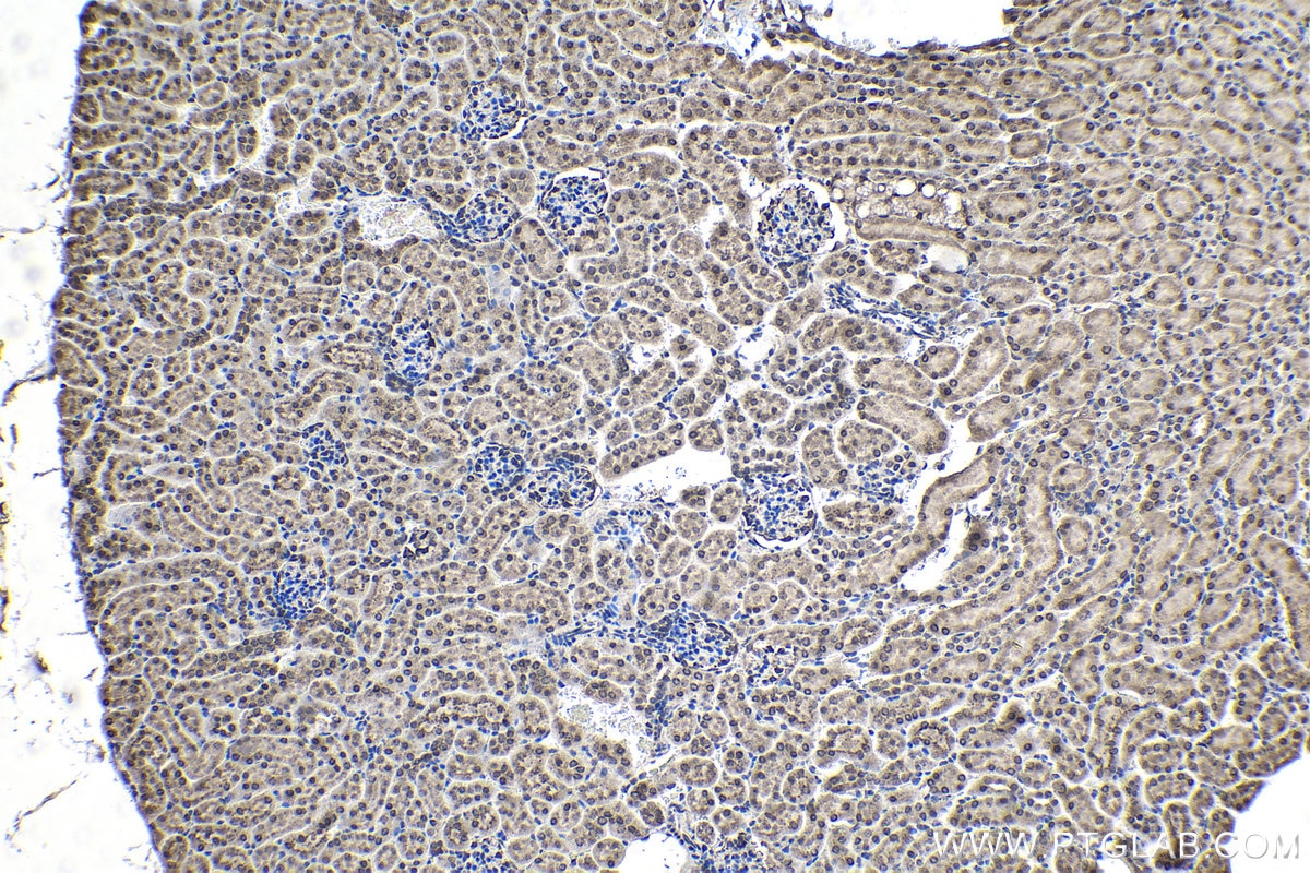Immunohistochemistry (IHC) staining of mouse kidney tissue using NUP214 Polyclonal antibody (24113-1-AP)
