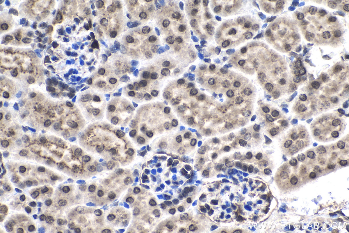 Immunohistochemistry (IHC) staining of mouse kidney tissue using NUP214 Polyclonal antibody (24113-1-AP)