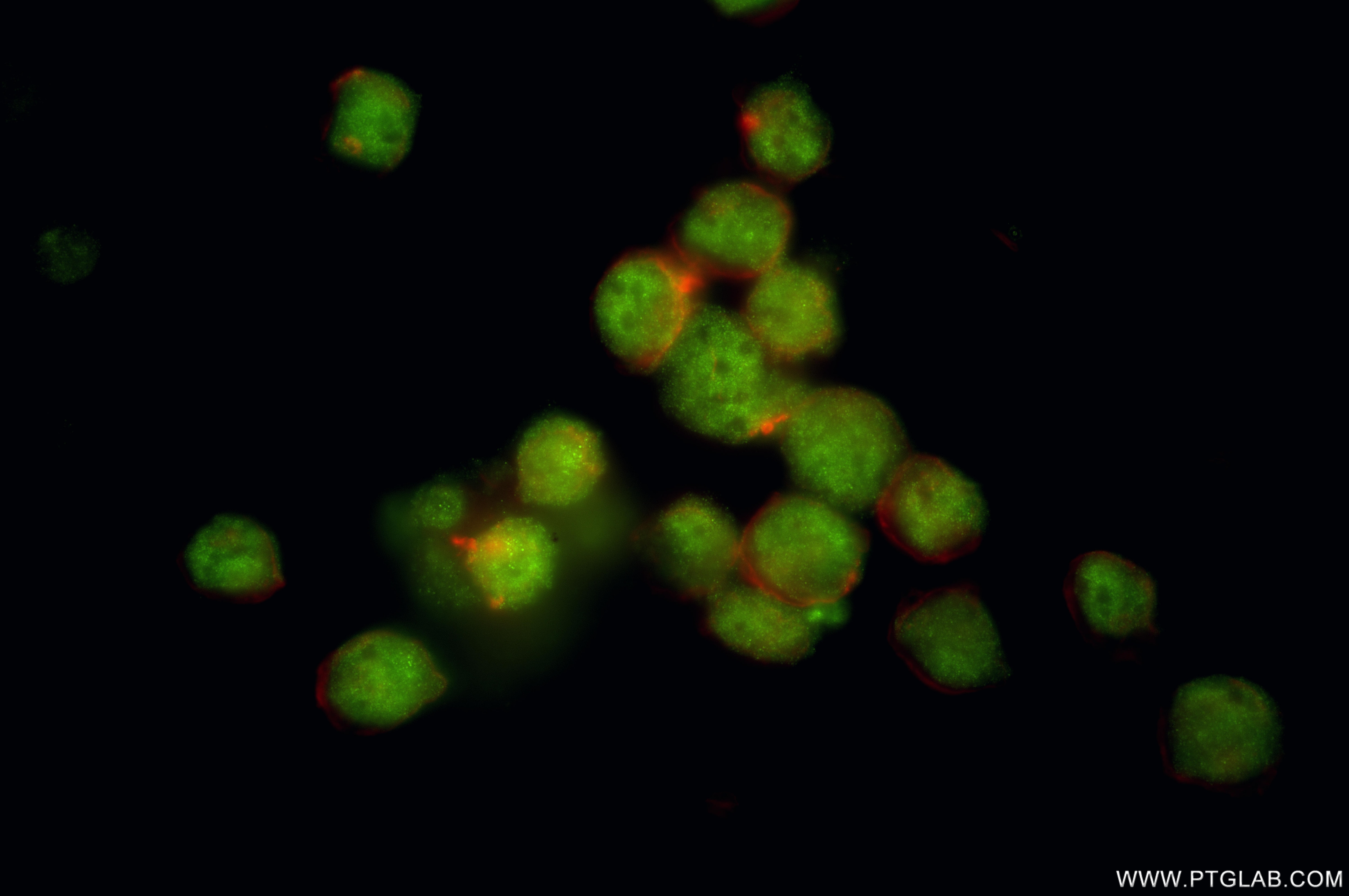 Immunofluorescence (IF) / fluorescent staining of K-562 cells using NUP214 Recombinant antibody (85161-4-RR)