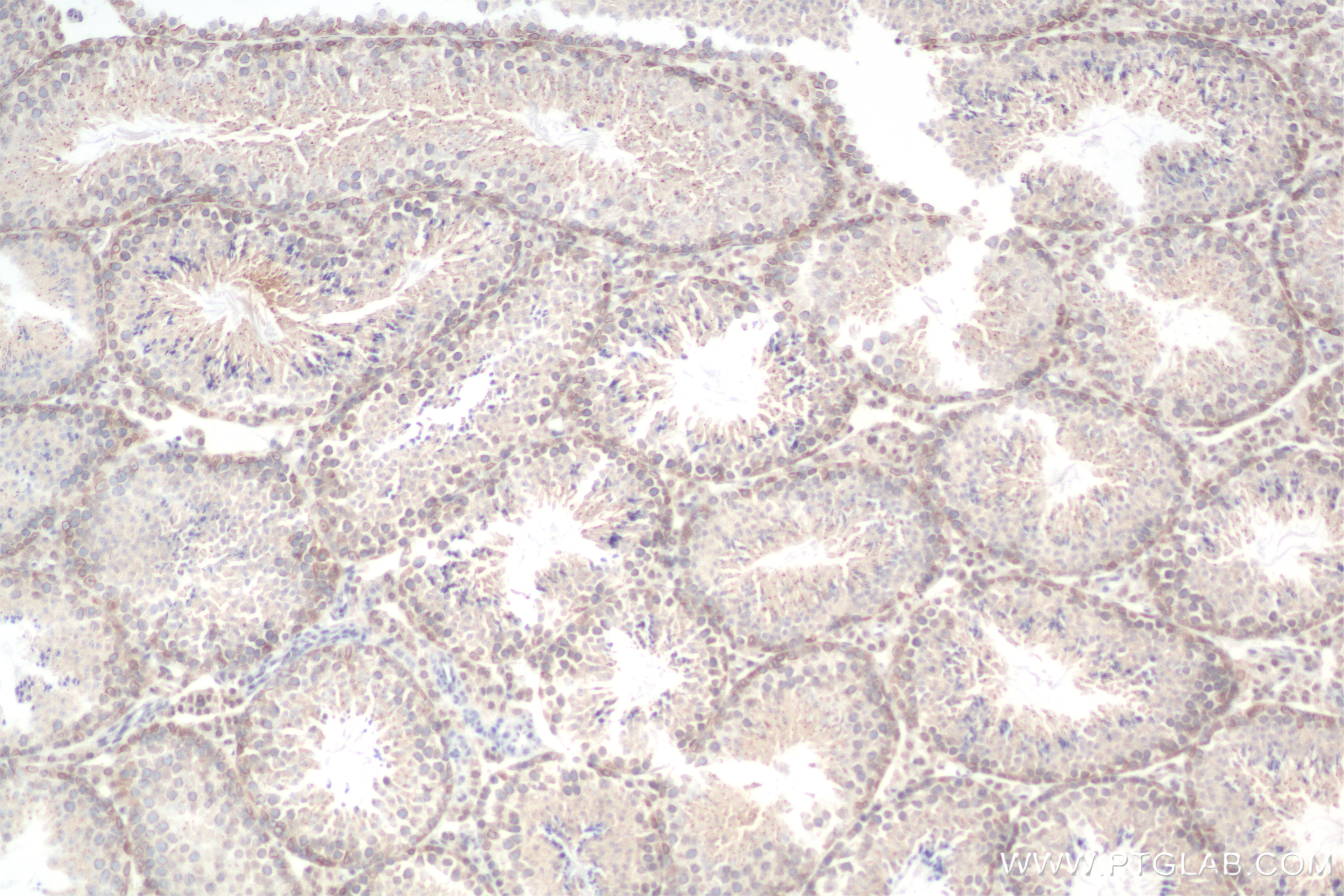 Immunohistochemistry (IHC) staining of mouse testis tissue using NUP214 Recombinant antibody (85161-4-RR)