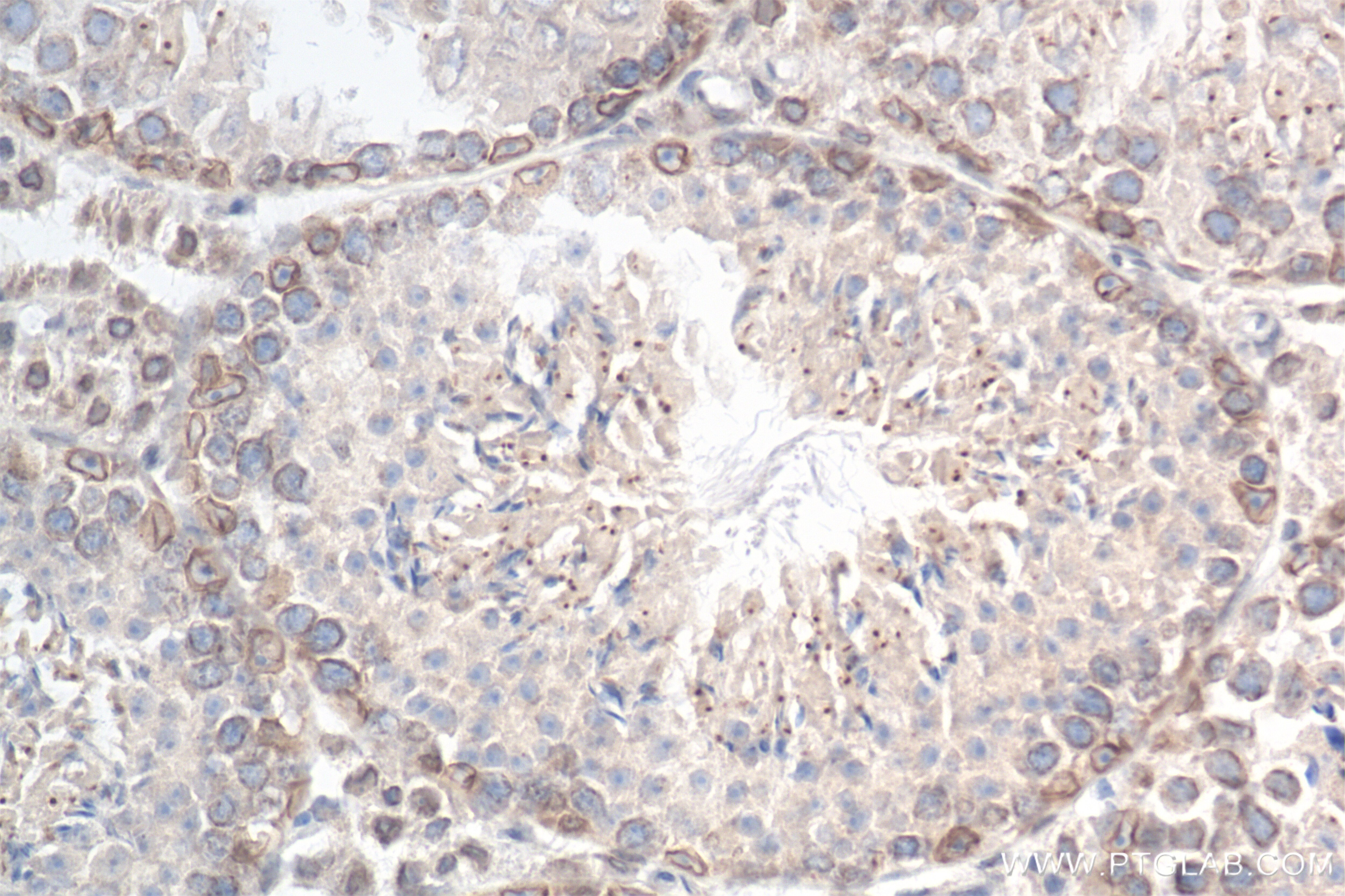 Immunohistochemistry (IHC) staining of mouse testis tissue using NUP214 Recombinant antibody (85161-4-RR)
