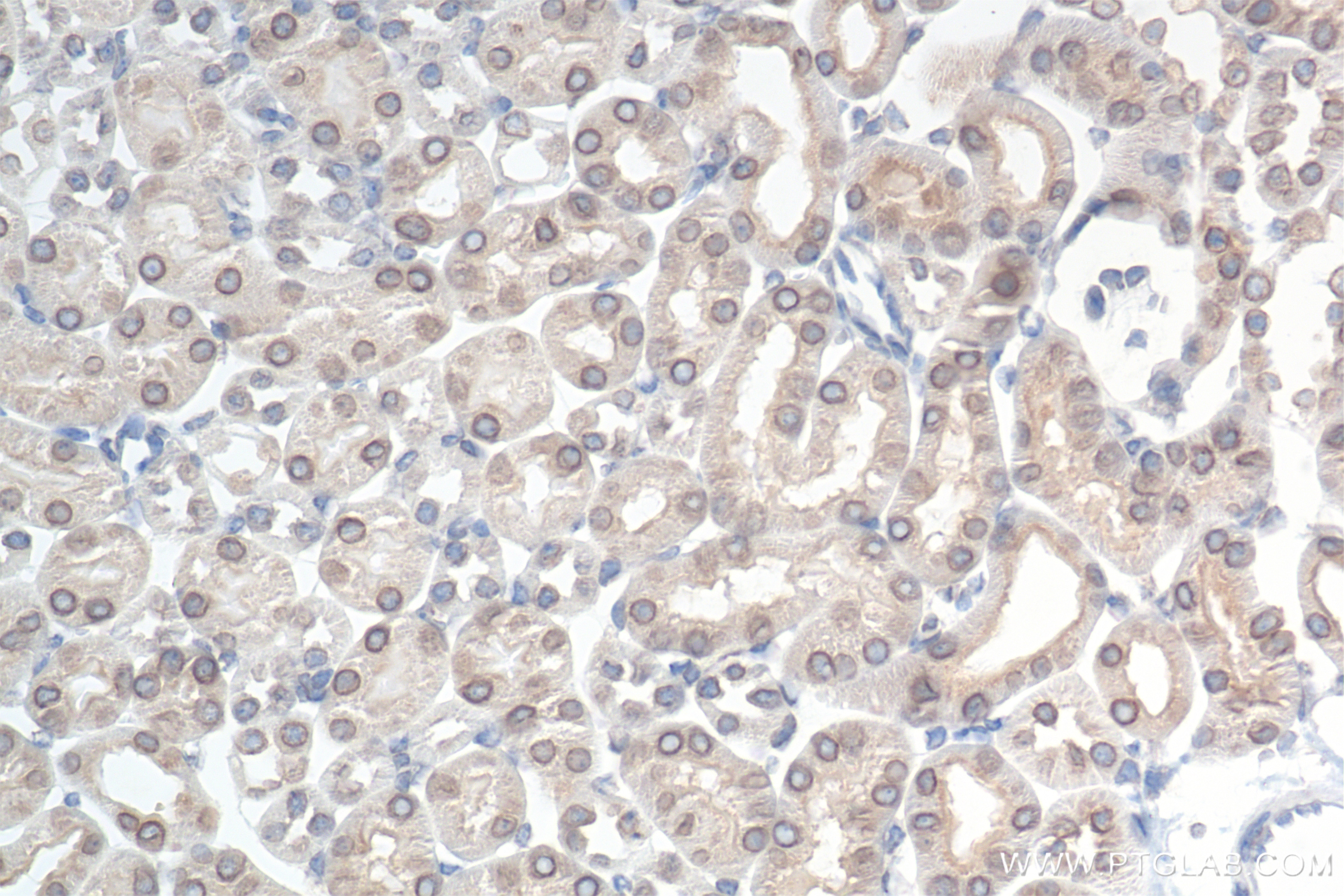 Immunohistochemistry (IHC) staining of mouse kidney tissue using NUP214 Recombinant antibody (85161-4-RR)