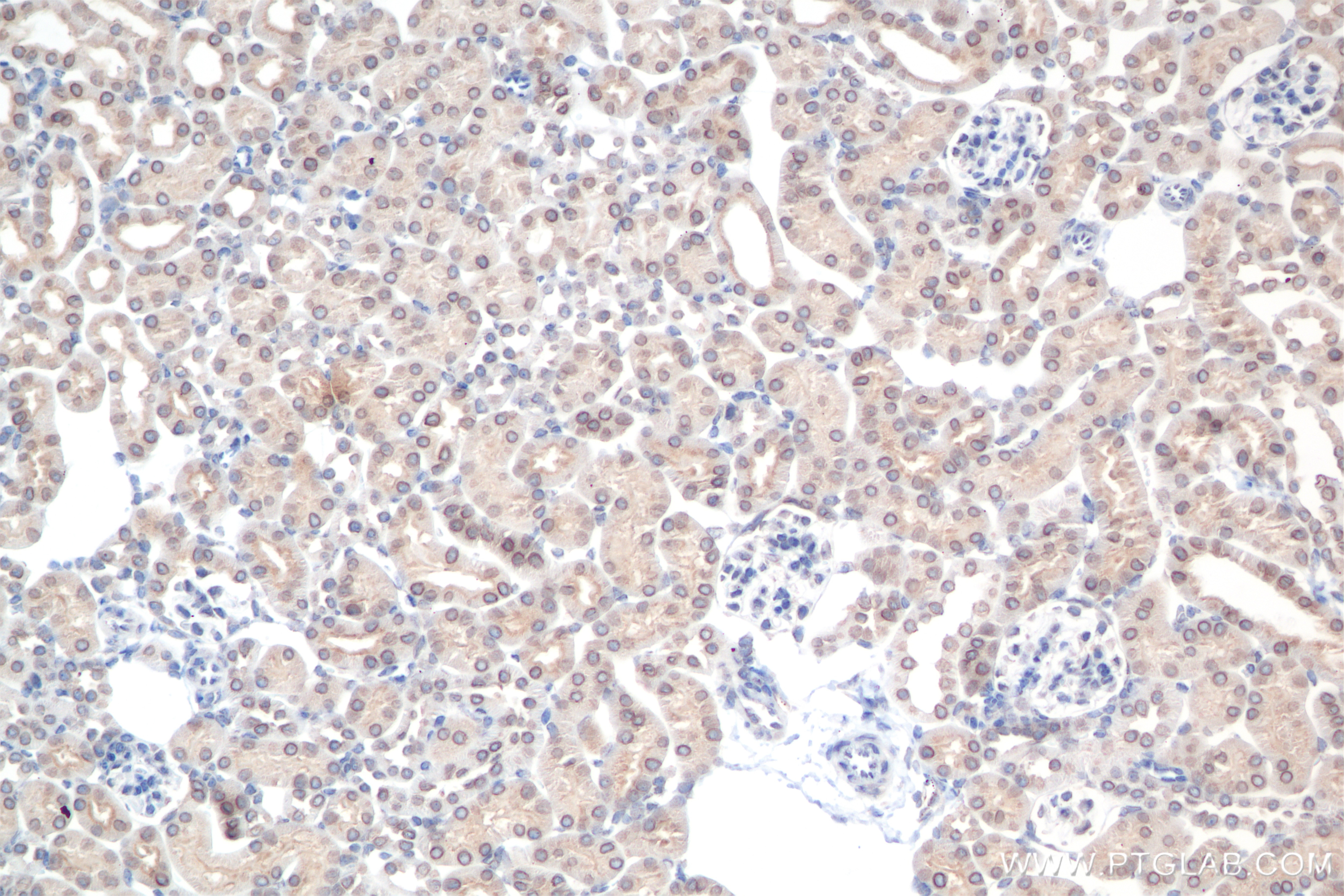 Immunohistochemistry (IHC) staining of mouse kidney tissue using NUP214 Recombinant antibody (85161-4-RR)