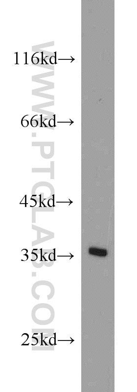 Western Blot (WB) analysis of K-562 cells using NUP53 Polyclonal antibody (19819-1-AP)
