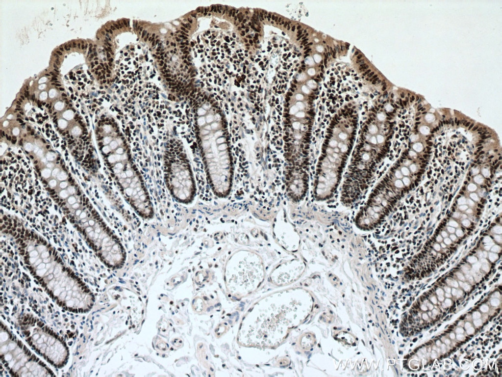 Immunohistochemistry (IHC) staining of human colon tissue using NUP50 Polyclonal antibody (20798-1-AP)