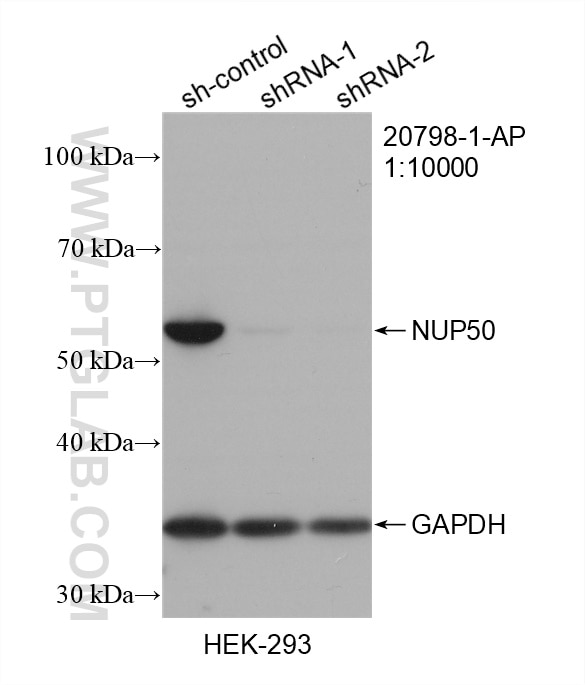 Western Blot (WB) analysis of HEK-293 cells using NUP50 Polyclonal antibody (20798-1-AP)