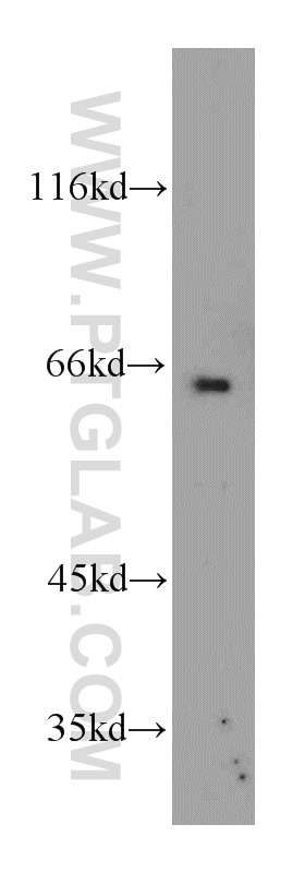 Western Blot (WB) analysis of mouse brain tissue using NUP50 Polyclonal antibody (20798-1-AP)