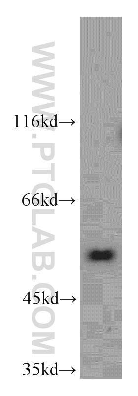 Western Blot (WB) analysis of Jurkat cells using NUP50 Polyclonal antibody (20798-1-AP)