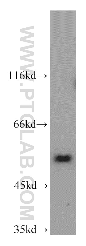 WB analysis of Jurkat using 20798-1-AP