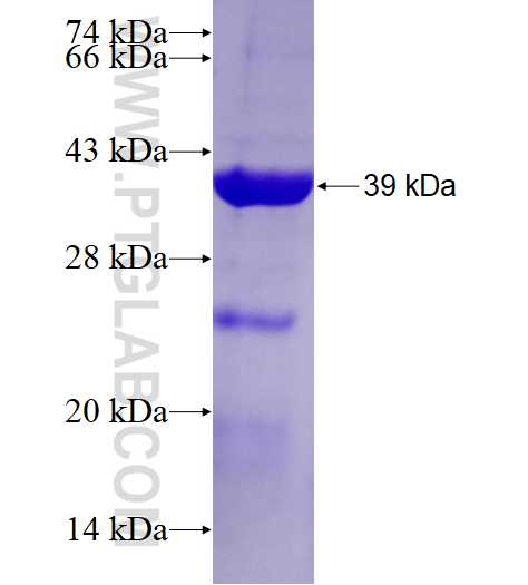NUP50 fusion protein Ag15144 SDS-PAGE
