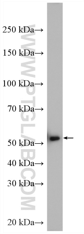 Western Blot (WB) analysis of K-562 cells using NUP54 Polyclonal antibody (16232-1-AP)