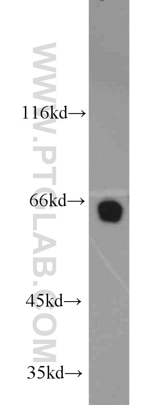 Western Blot (WB) analysis of PC-3 cells using NUP62 Polyclonal antibody (13916-1-AP)