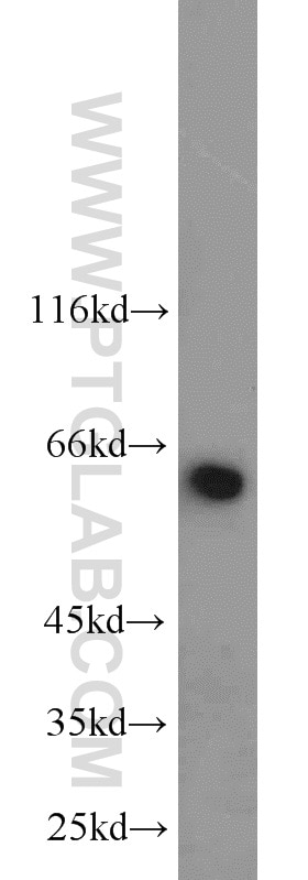 Western Blot (WB) analysis of NIH/3T3 cells using NUP62 Polyclonal antibody (13916-1-AP)
