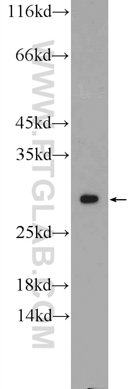Western Blot (WB) analysis of Jurkat cells using NUP62CL Polyclonal antibody (25381-1-AP)