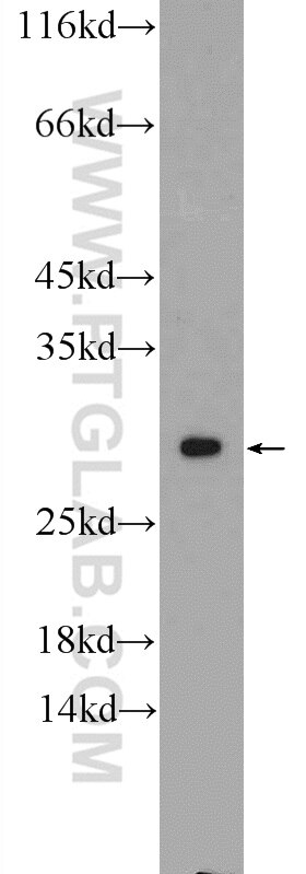 WB analysis of Jurkat using 25381-1-AP