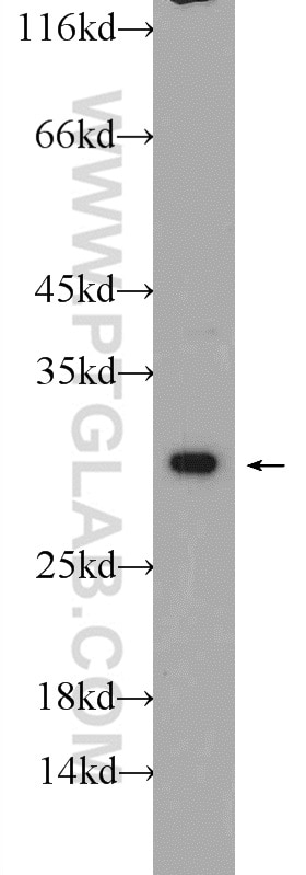 Western Blot (WB) analysis of SH-SY5Y cells using NUP62CL Polyclonal antibody (25381-1-AP)