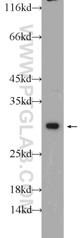 WB analysis of SH-SY5Y using 25381-1-AP