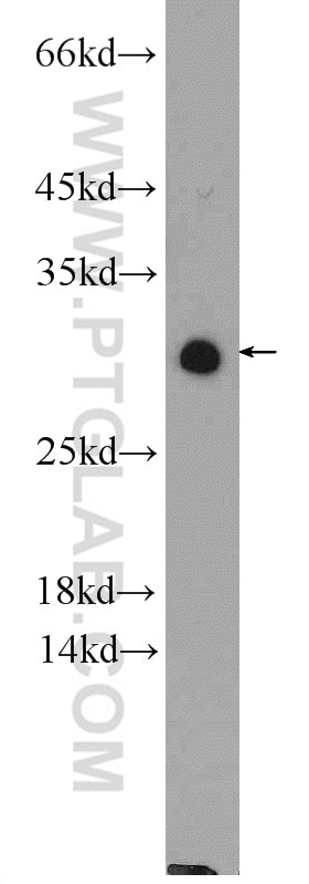 Western Blot (WB) analysis of HeLa cells using NUP62CL Polyclonal antibody (25381-1-AP)