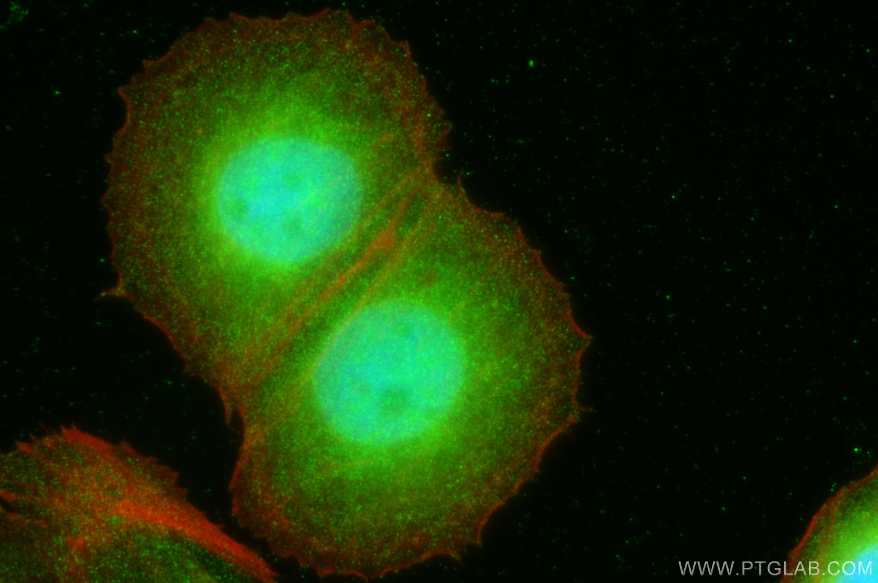 Immunofluorescence (IF) / fluorescent staining of MCF-7 cells using NUP85 Polyclonal antibody (15027-1-AP)