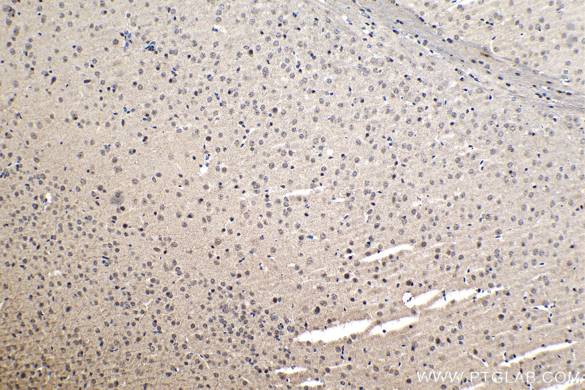 Immunohistochemistry (IHC) staining of mouse brain tissue using NUP85 Polyclonal antibody (15027-1-AP)